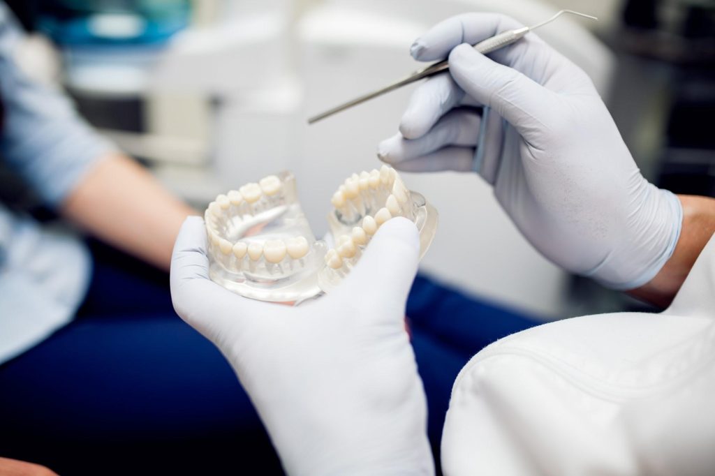 Dental Crowns: Everything You Need To Know